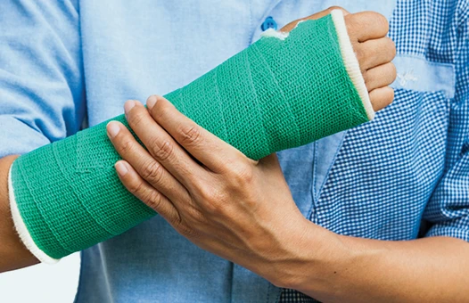 Arm cast