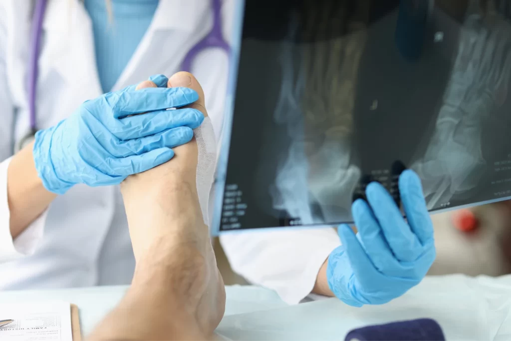 Fracture Clinic