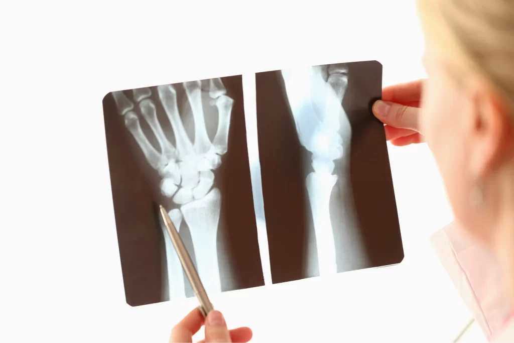 Fracture Clinic