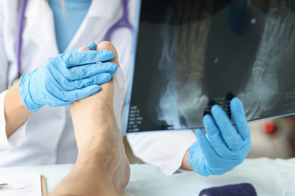 Musculoskeletal Injuries