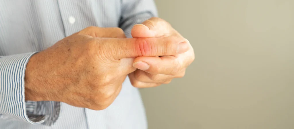 Interphalangeal Joint Dislocation