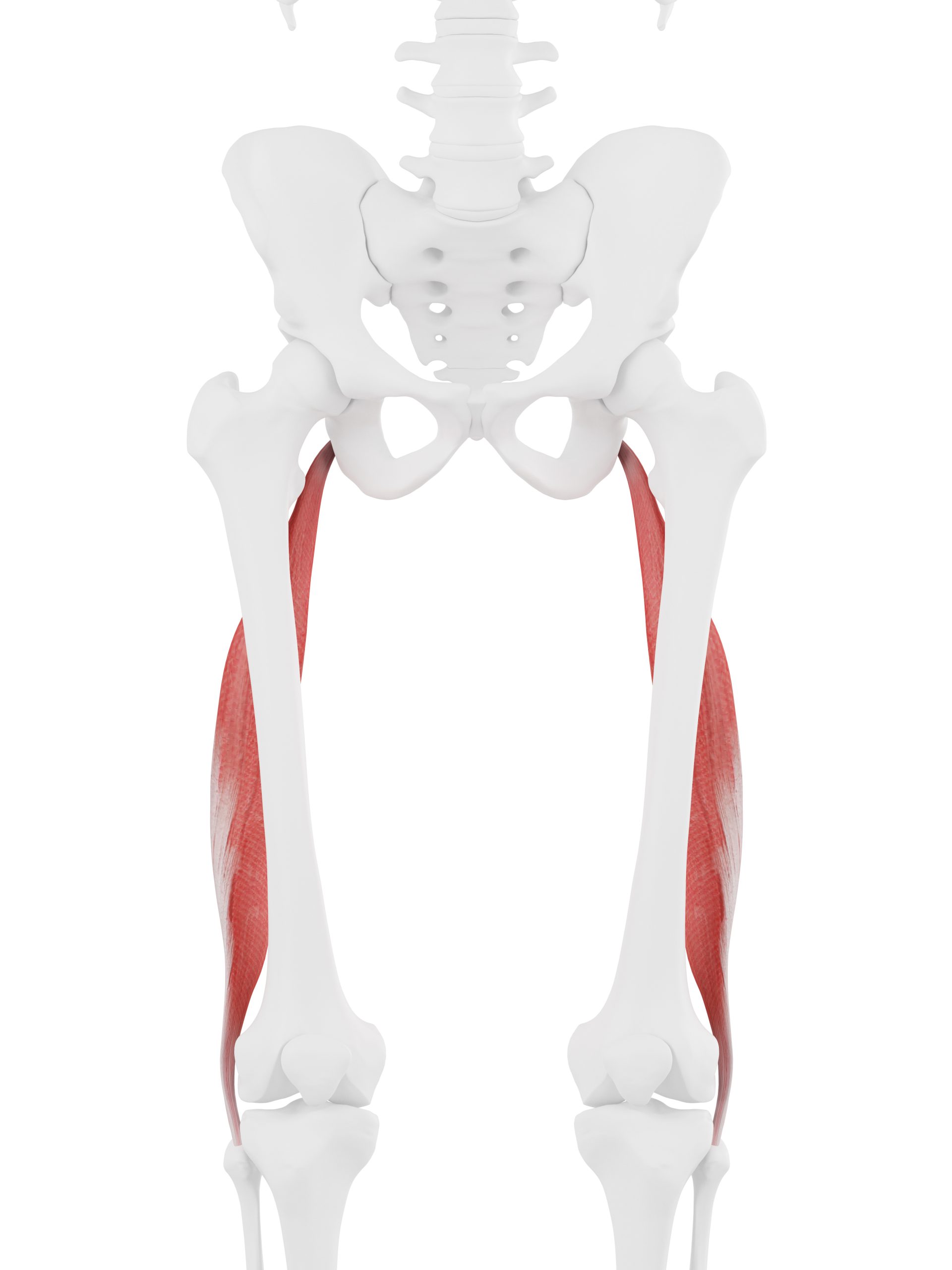 Femoral Fracture — Access Ortho