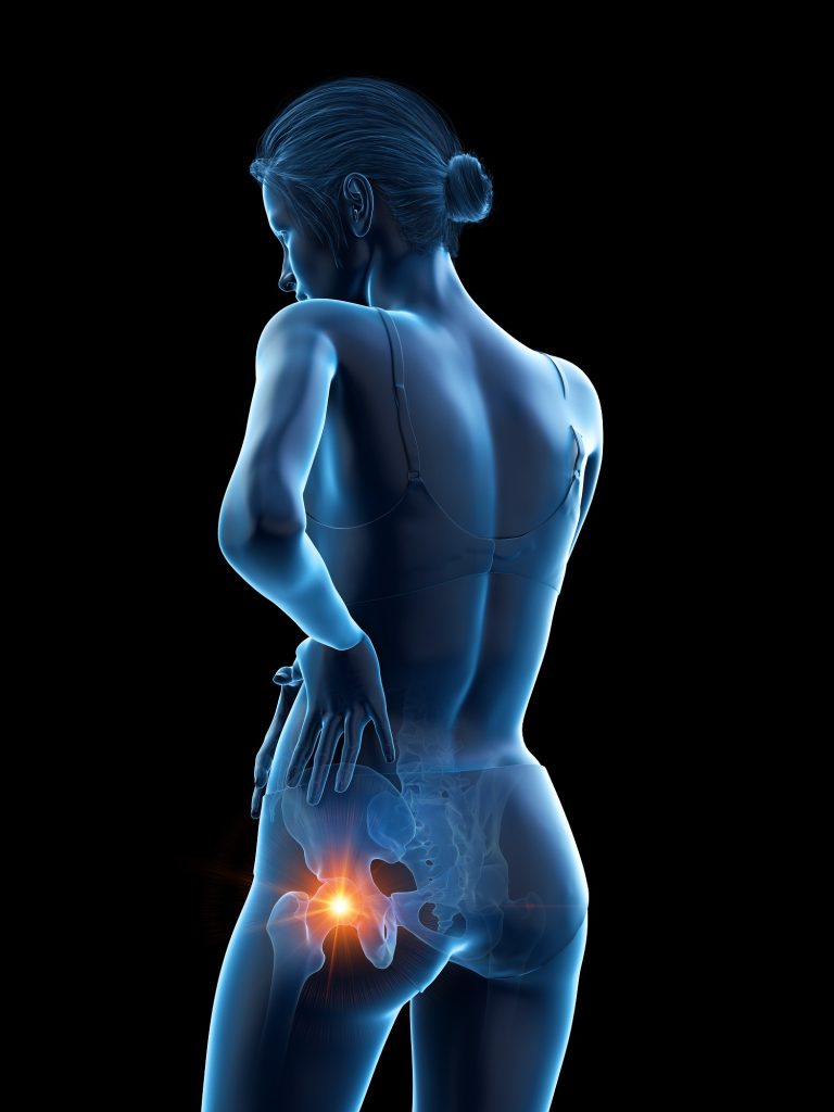 Hip Injuries
