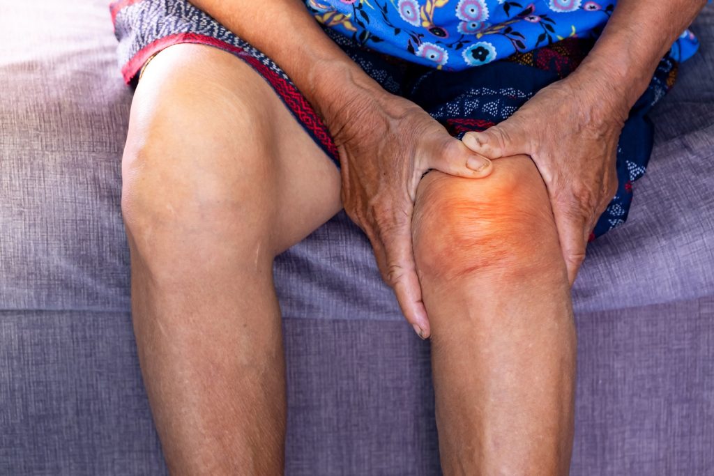Diagnosing Osteoarthritis Flares and Exacerbations