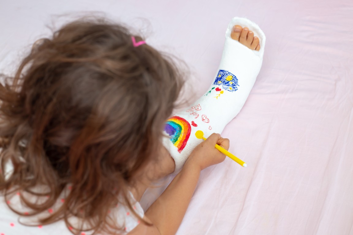 Paediatric Fractures