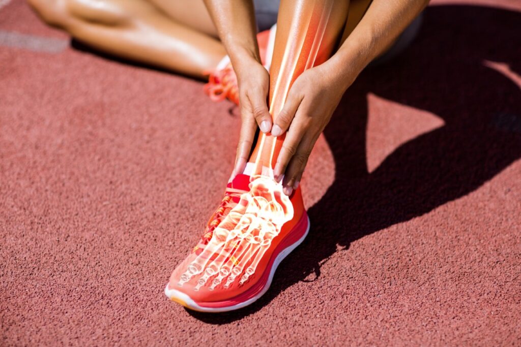 Syndesmotic Injury